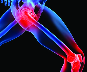 Заболевание Опорно-двигательного аппарата